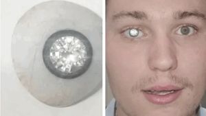 Povestea tânărului care și-a pus un diamant de 2 milioane de dolari în loc de ochi: ”A adus o lumină nouă în viața mea”