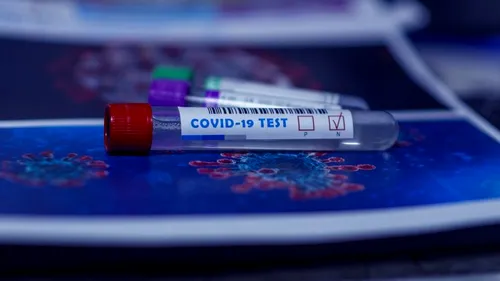 Coronavirus România, 10 ianuarie. 3.082 cazuri noi SARS – CoV – 2, diagnosticate în ultimele 24 de ore