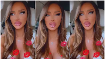 De ce își topește Bianca Drăgușanu acidul din buze. Vedeta a recunoscut ce s-a întâmplat