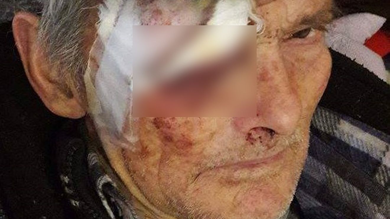 Şocant. O vâlceancă a postat pe Facebook poze cu tatăl ei, bătut crunt