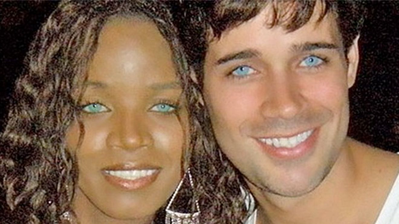 A platit 8.000 de dolari sa isi schimbe culoarea ochilor din caprui in verde deschis! Ce s-a intamplat la scurt timp dupa operatie