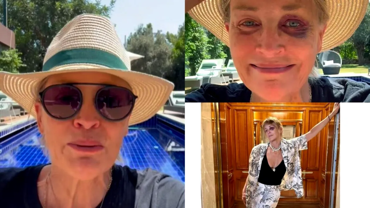 Sharon Stone s-a întors cu ochiul vânăt din vacanță. Actrița de 66 de ani și-a îngrijorat toți fanii