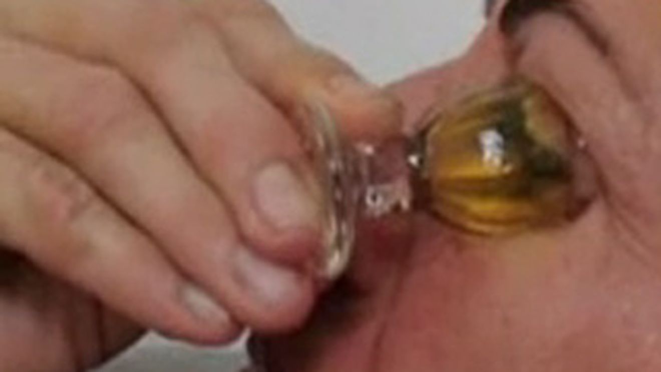 VIDEO ABSOLUT SCARBOS! O femeie bolnava de cancer (si nu numai) isi bea urina, o foloseste ca lotiune de fata si pasta de dinti - Uite cum arata dupa ce ani de zile a facut asta