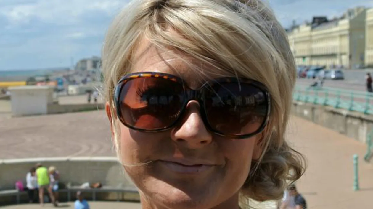 Si tie ti se poate intampla asa ceva daca mergi la solar! Cum a ajuns sa arate fata unei femei! A trebuit sa fie operata