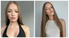 Silvia, o tânără de 23 de ani, dezvăluie drama prin care a trecut după ce a încercat să slăbească prin înfometare. Ajunsese să cântărească 38 de kilograme