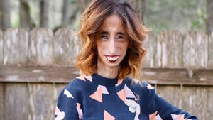 A fost catalogată “cea mai urâtă femeie din lume”, iar acum... Cum arată, în prezent, Lizzie Velasquez