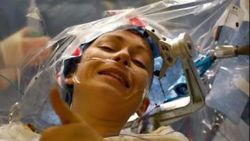 Operata pe viu pe creier