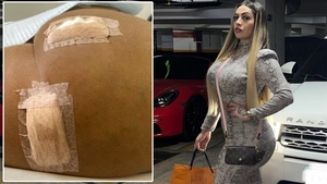 Ce a pățit tânăra din imagine, după ce și-a făcut o operație de remodelare a posteriorului, pe care a dat 9.230 de euro. Când s-a uitat în oglindă, să cadă din picioare