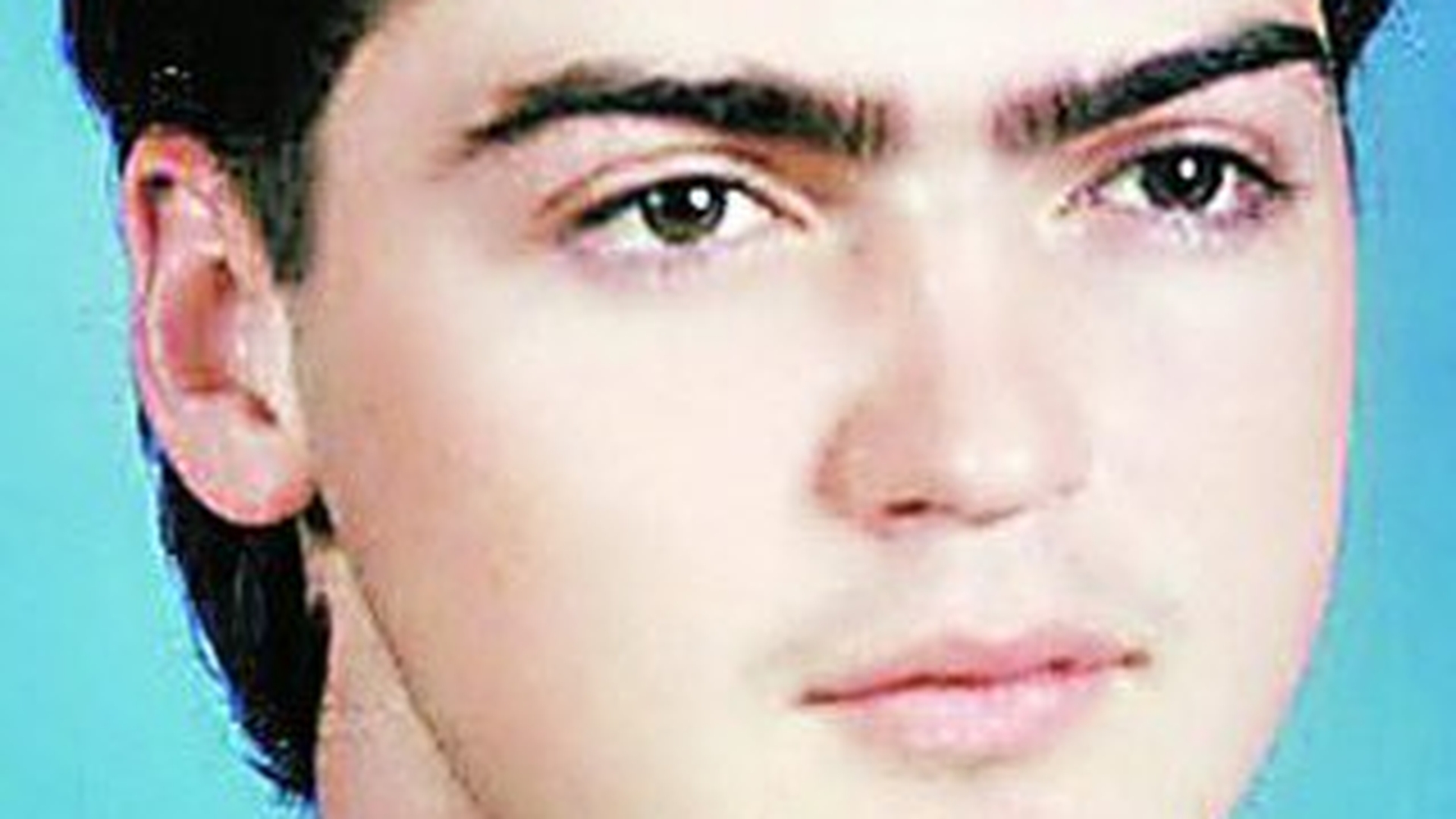 Un american a suferit cel mai complex transplant facial. Asa arata dupa ce a fost impuscat in fata