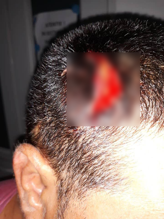 Victima a fost internată cu răni grave la cap