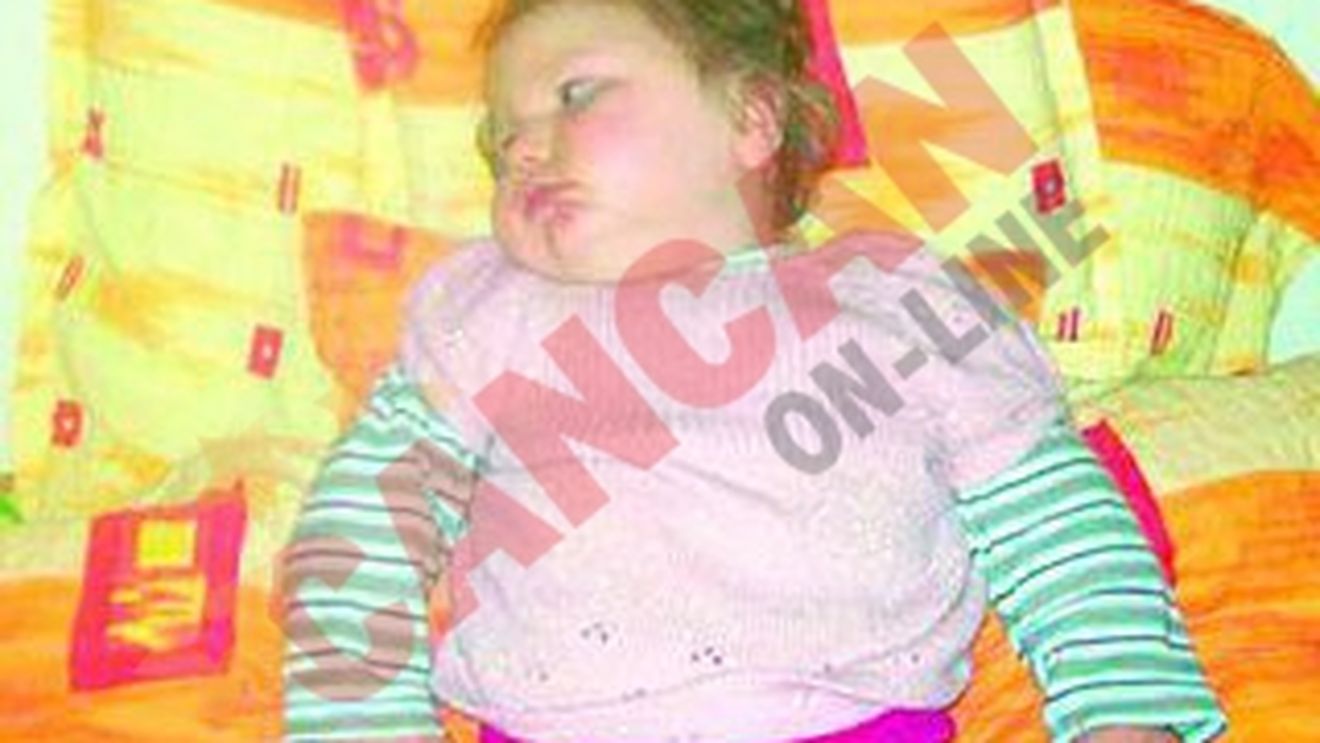 Are nevoie de transplant la numai doi ani