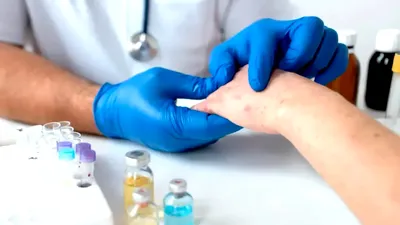 Un nou caz de lepră, confirmat în Europa! Țara apropiată de România este în alertă