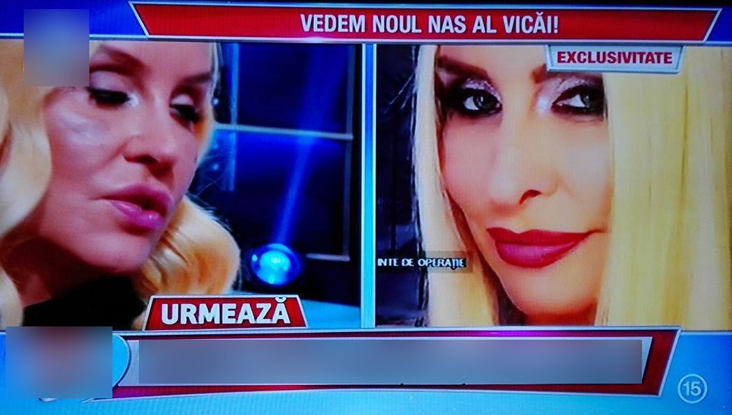 VICA BLOCHINA de nerecunoscut! Iată cum arată acum nasul ei proaspăt operat