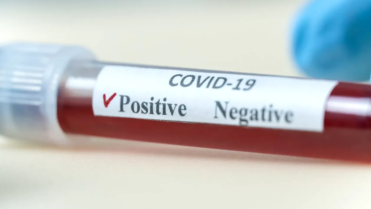 Coronavirus România, 3 mai 2021. Sub 700 de cazuri noi SARS-CoV-2, înregistrate în a doua zi de Paște