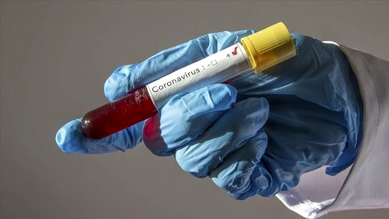 Coronavirus în România. 24 de decese în ultimele 24 de ore! Bilanțul este de 1.871