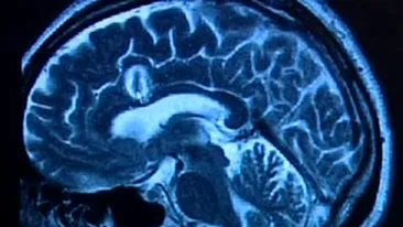 Sportul imbunatateste memoria celor trecuti de 55 de ani