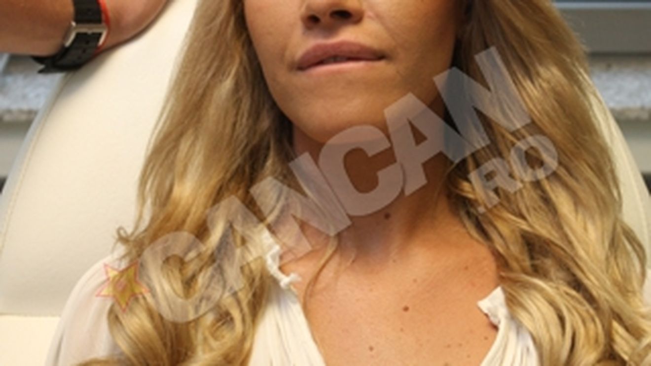 Raluca Podea s-a internat ieri pentru analize amanuntite! Este suspecta de cancer ovarian