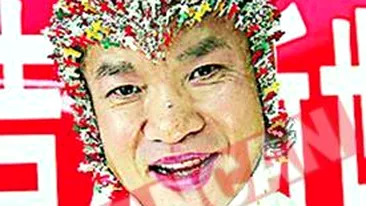 Si-a infipt mii de ace in corp