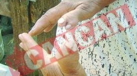 Tamaduitoarea cu 12 degete