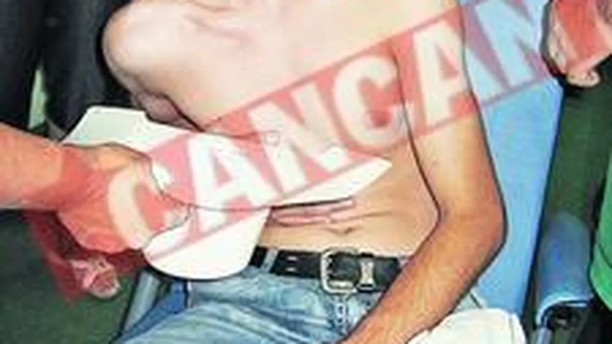 Batuti fara motiv de politistii comunitari