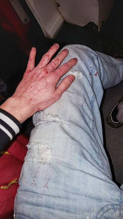 Imagini cutremuratoare postate pe Facebook de un tânăr din Târgu Jiu, după ce a suferit un accident rutier: „Am văzut moartea cu ochii, s-a oprit…”
