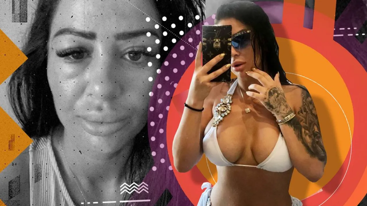 O bombă-sexy acuză medicul estetician că i-a greșit intervenția: “Am apăsat într-o seară pe ochi și mi-a ieșit un...”