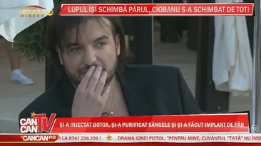 Ciobanu a intrat in renovare: implant de par, botox impotriva transpiratiei, tratamentul Dracula. Urmeaza o interventie la pometi