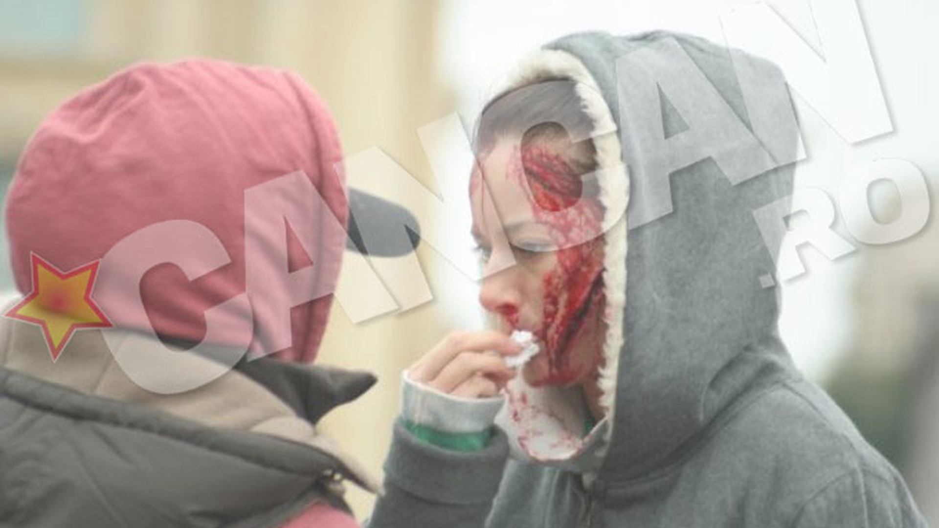 Imagini terifiante cu Laura Cosoi! A iesit in plina strada batuta mar, taiata pe fata si cu sangele curgand siroaie