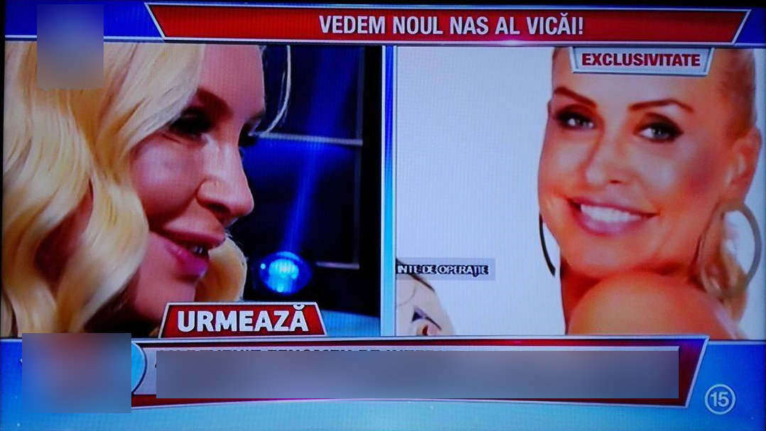 VICA BLOCHINA de nerecunoscut! Iată cum arată acum nasul ei proaspăt operat