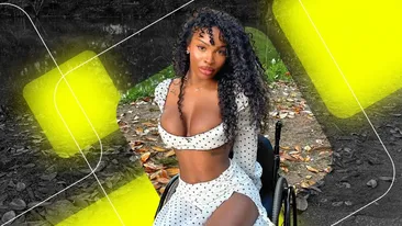 „Barbie în scaun cu rotile”, povestea influenceriței care inspiră milioane de oameni. Afecțiunea rară care i-a schimbat radical viața