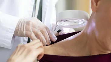 Studiu: Femeile au o rată mai mare de supraviețuire la cancer decât bărbații