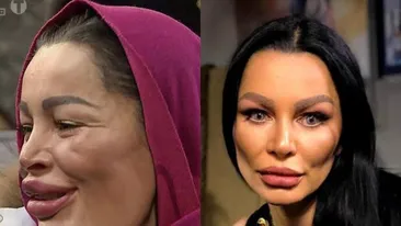Cum arăta Brigitte înainte de operaţiile estetice? Cu ultima intervenţie l-a şocat şi pe Florin Pastramă. Galerie FOTO