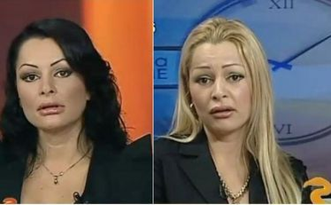 Brigitte a scos din buzunar o avere ca să se "tuneze"!