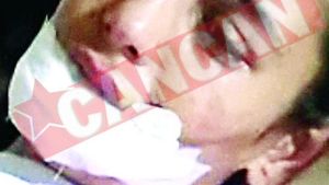 I-a taiat buza concubinei pentru ca vorbea prea mult