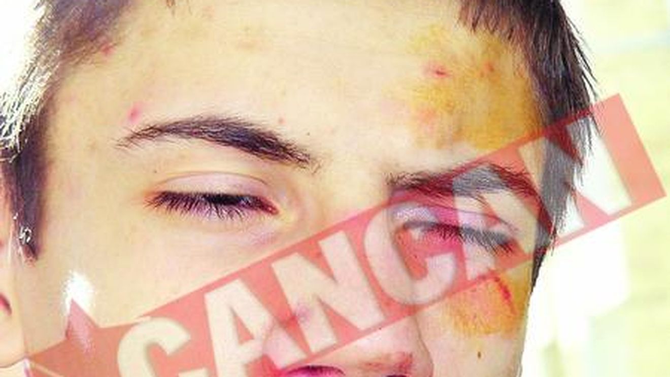 Elev ungur batut de extremistii romani