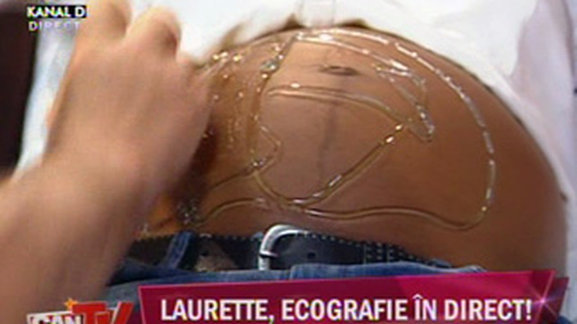 VIDEO PREMIERA! Ecografie in direct! Laurette si-a vazut copilul nenascut pe post!