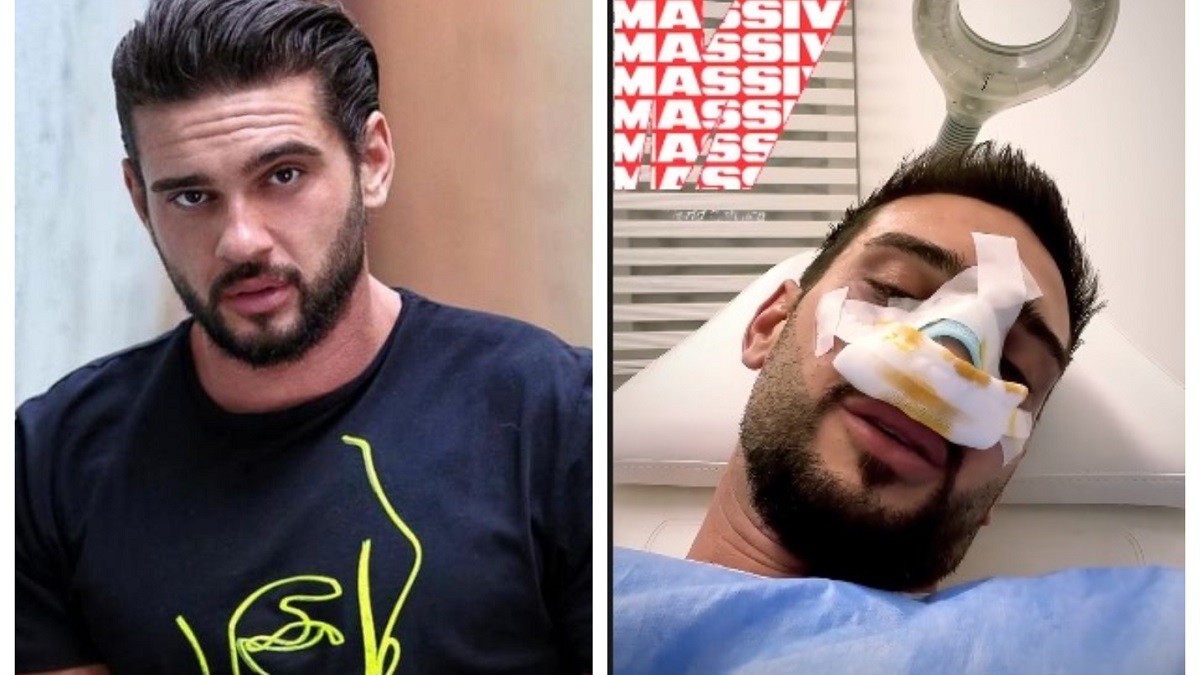 A zis că nu-și va opera nasul niciodată, dar s-a răzgândit! Cum arată Dorian „Hâtz” Popa, după ce și-a făcut rinoplastie
