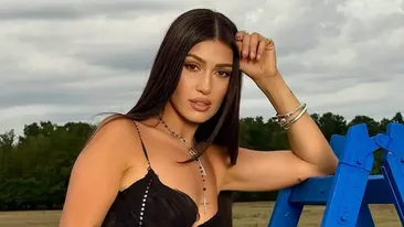 Alina Eremia și-a uimit fanii după ce a apărut cu fața umflată pe Instagram. Ce a pățit cântăreața în urmă cu puțin timp