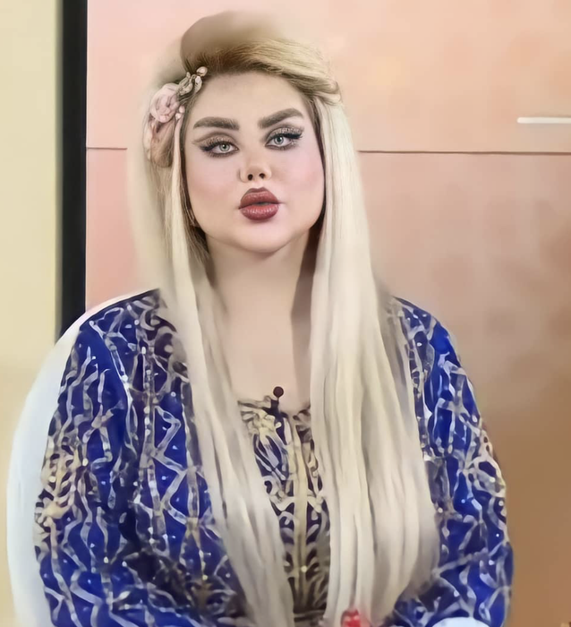 Dalia a vrut să arate ca păpușa Barbie, dar rezultatul i-a șocat pe apropiați. După 43 de operații, tânăra de 30 de ani este asemănată cu un zombi