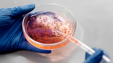 Bacteria extrem de periculoasă, care te poate ucide! În ce alimente o poți găsi