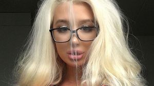 Un model care visează să devină Barbie, la un pas de moarte din cauza operaţiilor!