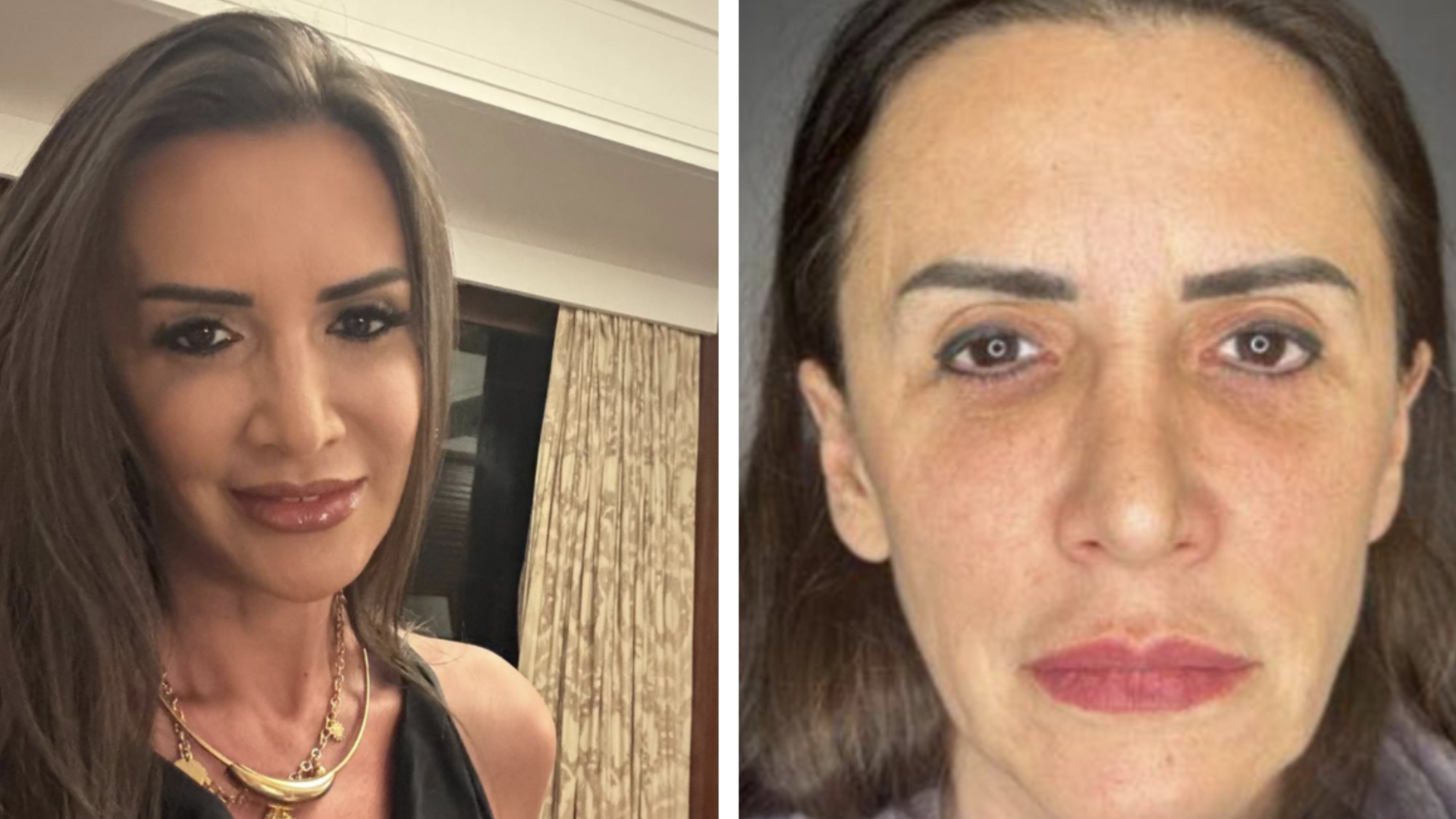 Mara Bănică, mesaj dur pentru cei care au criticat-o că și-a făcut lifting facial: ”Era mai bine să fi spus că m-am apucat de yoga?!”