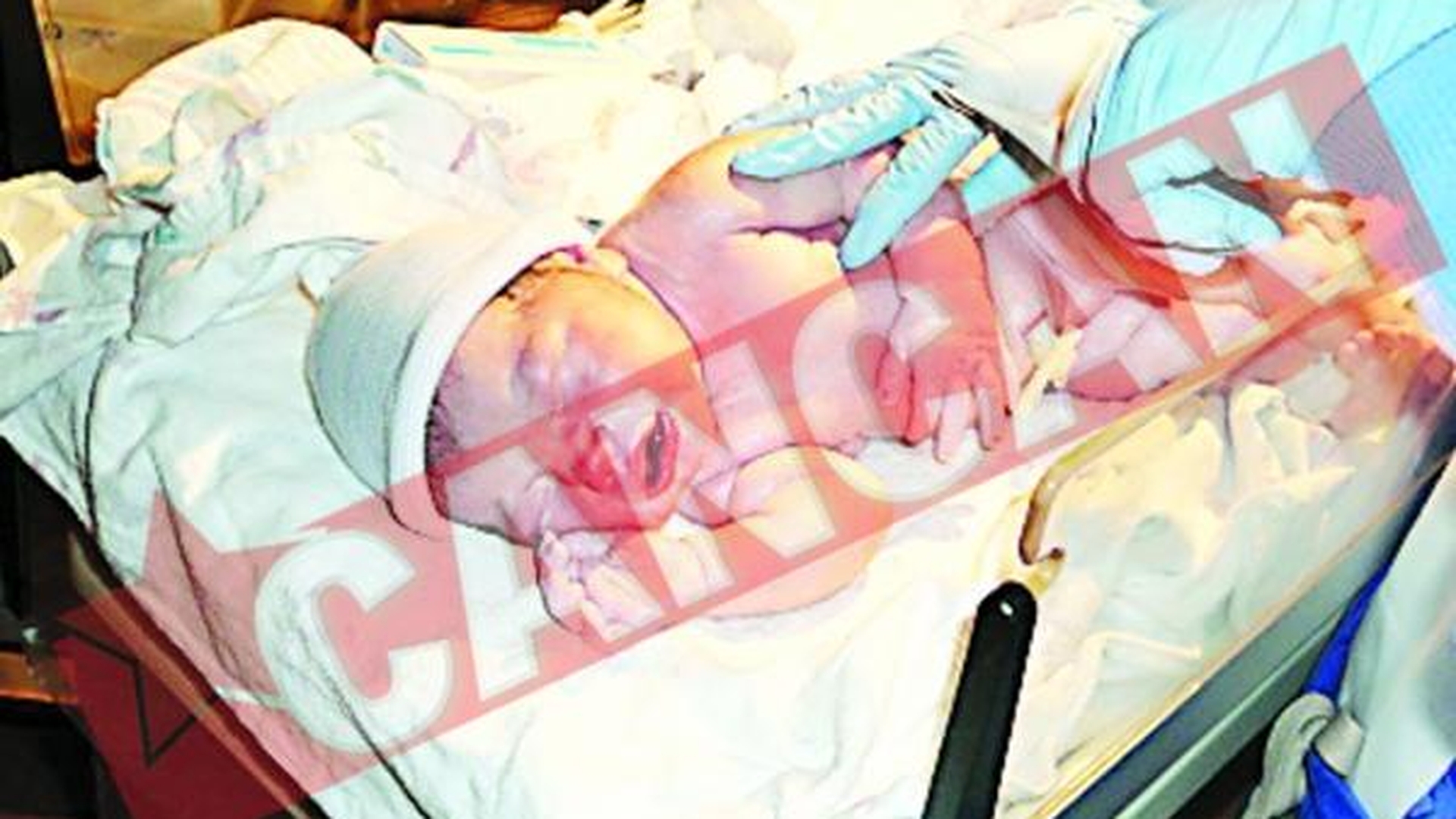 S-a nascut in coma alcoolica