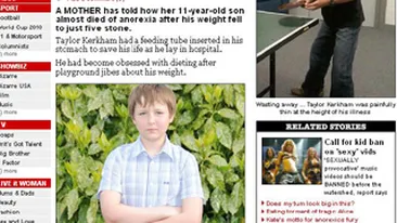 Anorexic la 11 ani: Refuzam sa ma spal! Credeam ca si sapunul are calorii!