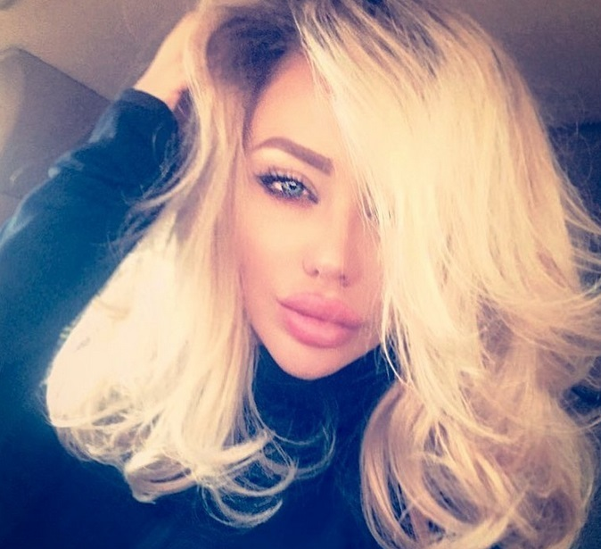 Bianca Drăguşanu şi-a mărit din nou buzele