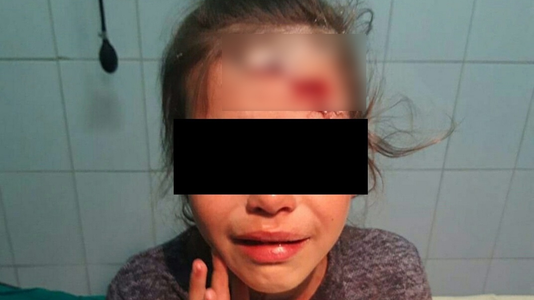 O fetiță din Călărași a ajuns la spital cu capul spart, după ce patroana unui magazin ar fi lovit-o cu un borcan de bulion