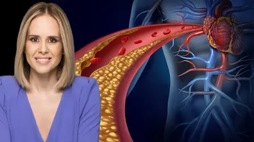 Alimentul care ne scapă de colesterol, potrivit medicului nutriționist Mihaela Bilic: Dacă sunteți sedentari, ajută