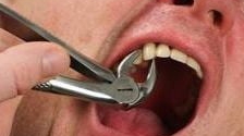 Eugen a murit după ce şi-a scos singur doi dinţi. Nu avea bani să meargă la dentist