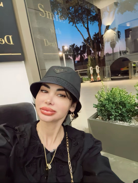 Alina Eriko începe să își revină. Cum arată acum, după ce și-a refăcut dantura