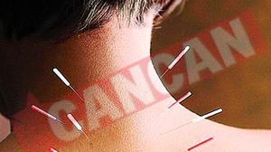 Ce boli se pot vindeca prin acupunctura